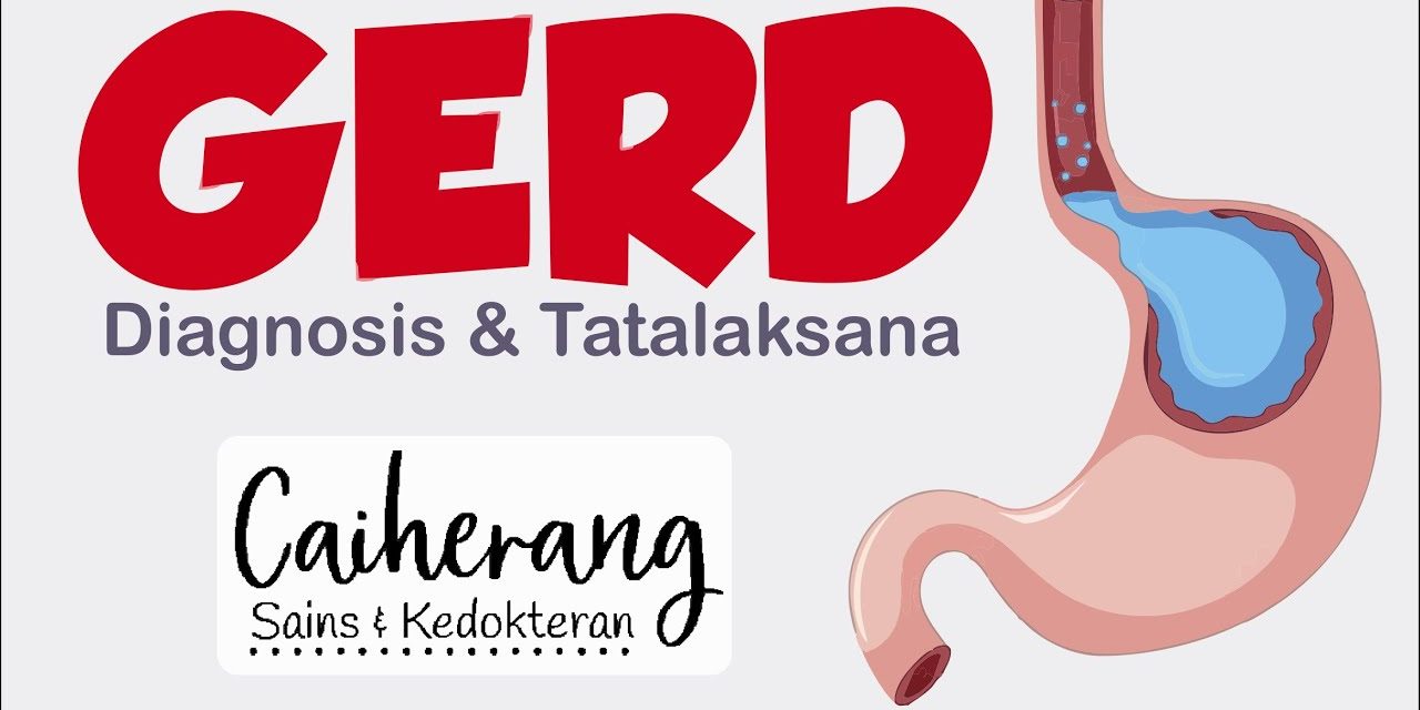 Penyakit Refluks Gastroesofageal Menyebabkan Tekanan Di Perut