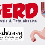 Penyakit Refluks Gastroesofageal Menyebabkan Tekanan Di Perut